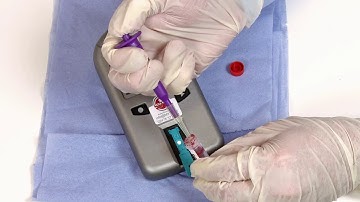 External Quality Assurance (EQA) Test (Official UK Suppliers)