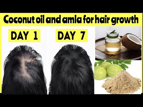 coconut oil and amla powder for hair growth |amla powder for hair ...