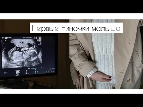 18-АЯ НЕДЕЛЯ БЕРЕМЕННОСТИ | ДНЕВНИК БЕРЕМЕННОСТИ | ПЕРВЫЕ ПИНОЧКИ МАЛЫША