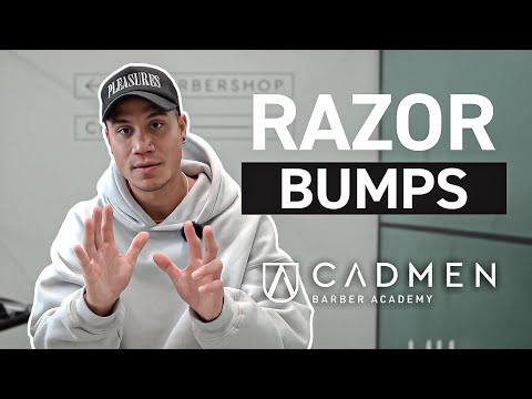 How to Prevent and Treat Razor Bumps | Barber Guide to Skincare & Client Aftercare