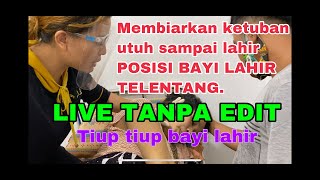 Posisi bayi keluar telentang dengan mudah, kontraksi  sedikit. Say no INDUKSI. Tiup tiup !!