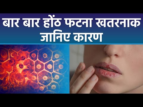 वीडियो: मेरा होंठ क्यों रो रहा है?