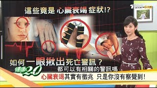 累喘腫竟是「心臟衰竭」症狀心臟要有力趕快練握力健康2.0 (完整版)