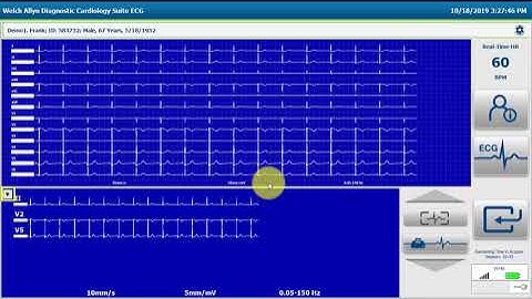 Welch Allyn® Diagnostic Cardiology Suite™ Resting ECG Workflow