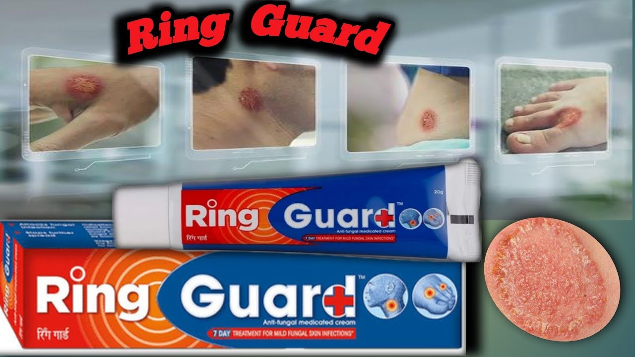 12g Ring Guard Anti Fungal Medicated Cream Relief From Ringworm & Skin  Infection for sale online | eBay
