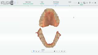 Intelliscan 3D How to do a Plan Report