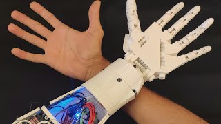 3D Printed EMG Prosthetic Hand