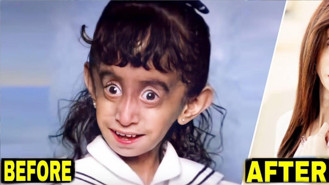No One Wanted To Adopt This Ugly Girl Years Later She Looks Completely Different Youtube 