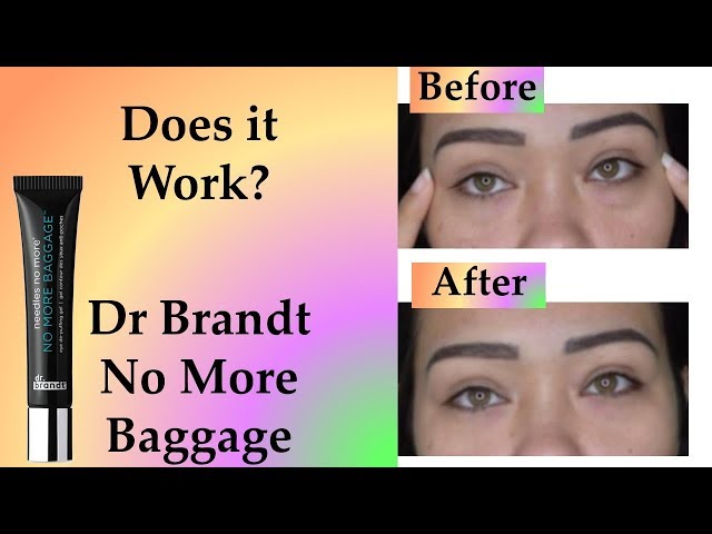 DR. BRANDT needles no more NO MORE BAGGAGE review (Before & After Dr Brandt)  