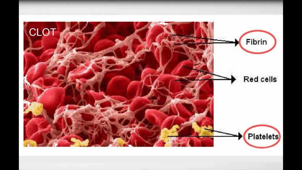 Тромбоциты и тромбы. Фибрин, эритроциты, тромбоциты.