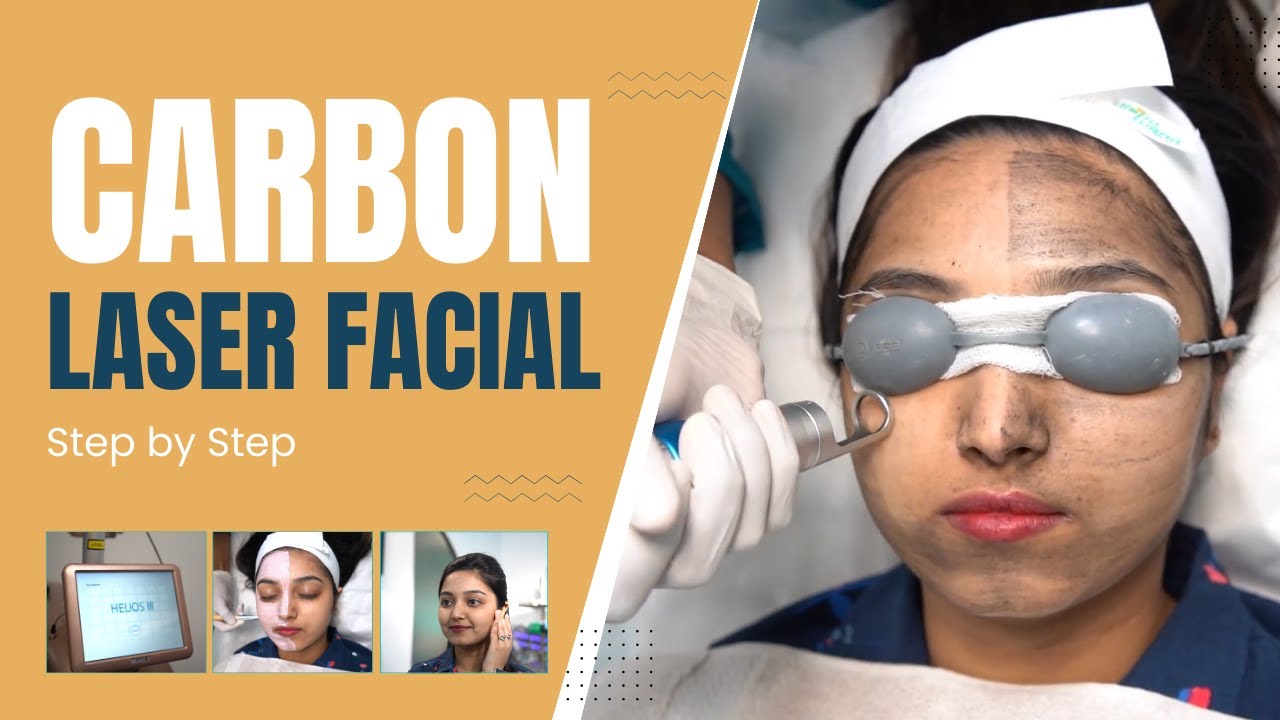 Carbon Laser Facial Treatment for glowing skin Carbon Laser Facial in