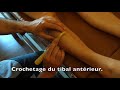 Crochetage du tibia antrieur dans la priostite antrieure