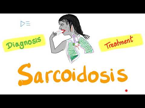 Video: Sarkoidas