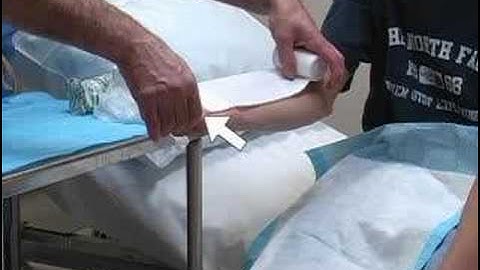 Short Arm Splint (sample) - www.proceduresconsult.com