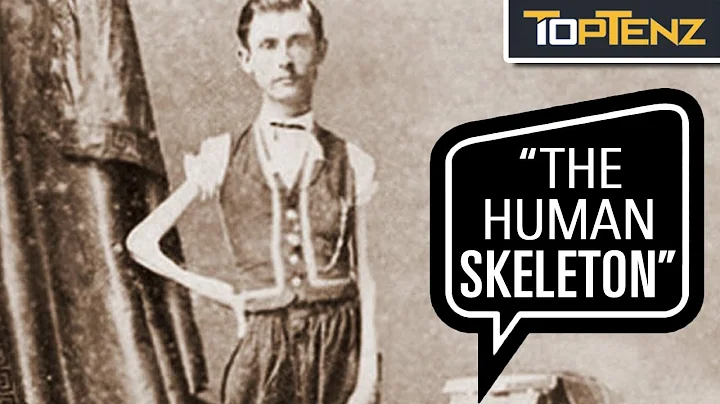 P. T. Barnums 10 Most Famous Human Freak Show Attr...