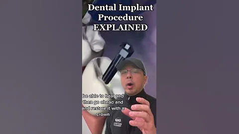 Dental Implant Procedure (EXPLAINED) | In Office to Hands On Dental Training