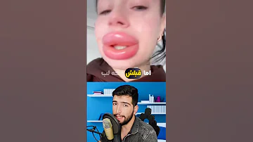 اگه میخواین از فیلر لب استفاده کنید یه کم صبر کنید 