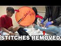 Nidal Wonder IS NOW GETTING STITCHES REMOVED FROM His LEG?! 😱😳 (Doctor checkup) **With Proof**