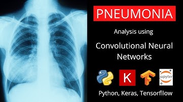 Pneumonia Analysis using Convolutional Neural Networks, Tensorflow, Keras and Python