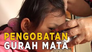 Dengan pengobatan terapi ini mata terlihat lebih bersih dan terang | JELANG SIANG