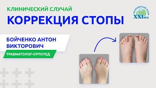 Деформация стопы: лечение и коррекция | Медицинский центр «XXI век»