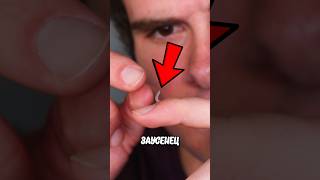 Никогда Не Отрывайте Заусениц! 😱