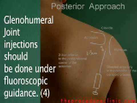 Steroid injection shoulder youtube