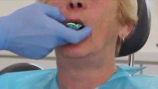 Maxillary primary impression for complete denture