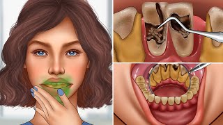 ASMR Remove giant tartar stuck between teeth | Dental care animation