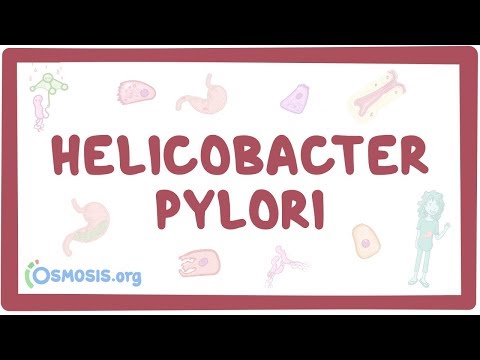 Helicobacter pylori Diagnosis. 