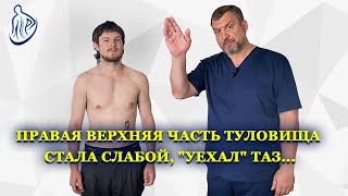 🟢ПРАВАЯ ВЕРХНЯЯ ЧАСТЬ ТУЛОВИЩА СТАЛА СЛАБОЙ, "УЕХАЛ" ТАЗ...