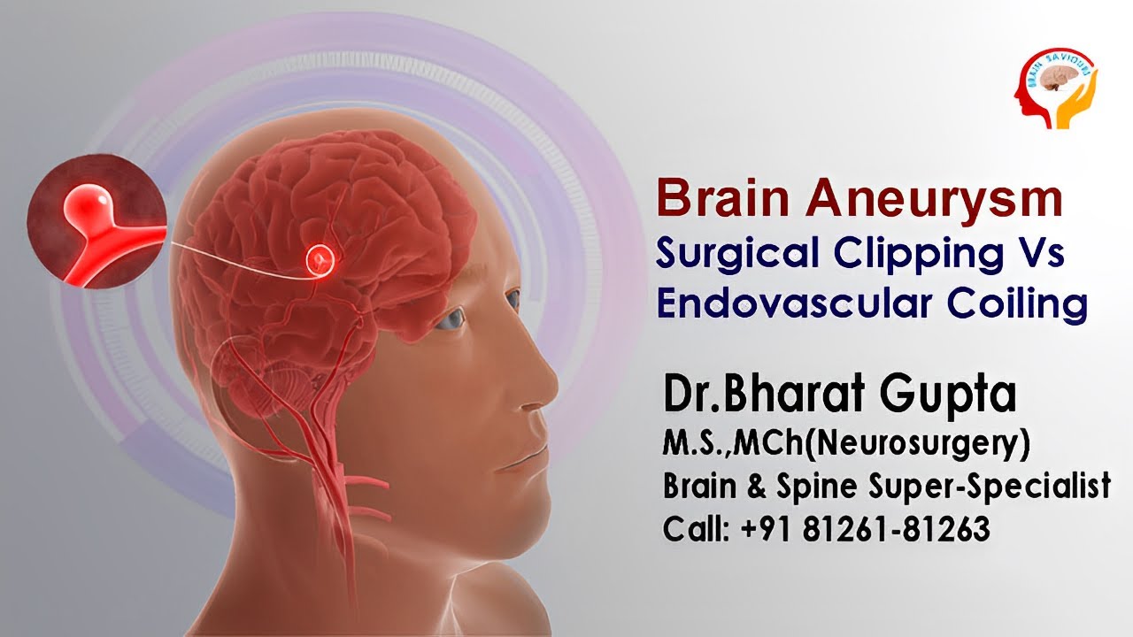 Brain Aneurysm Surgical Clipping Vs Endovascular Coiling I Dr. Bharat ...
