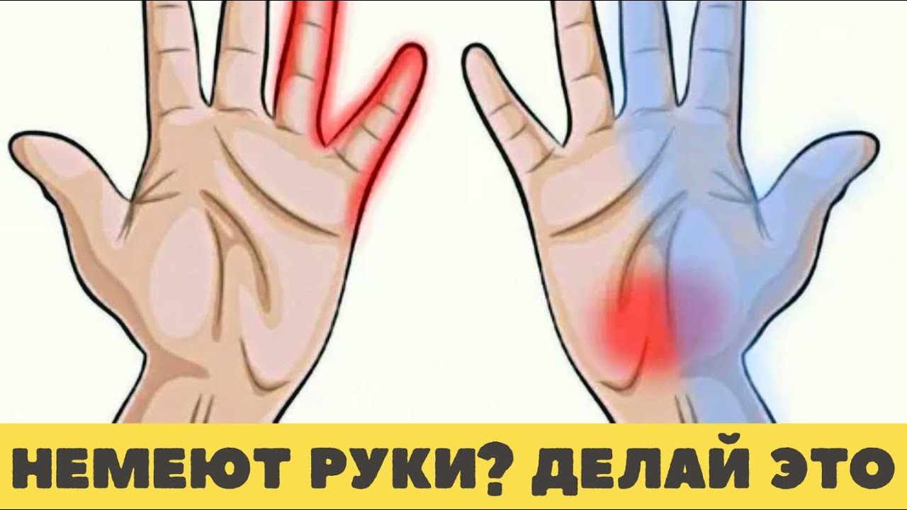 Немеют руки слабость руках