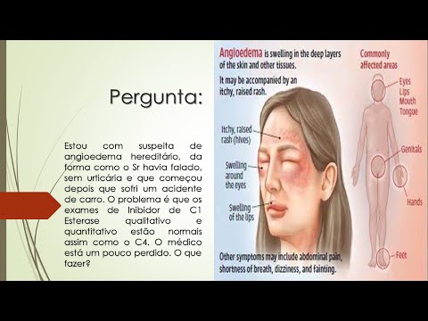 Vídeo: Angioedema Hereditário Por Deficiência De Inibidor De C1 Na Suíça: Características Clínicas E Modalidades Terapêuticas Em Um Estudo De Coorte