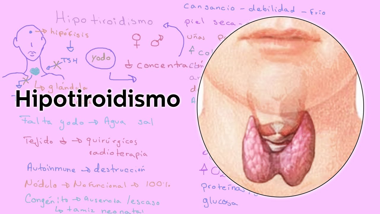 Alimentos malos hipotiroidismo