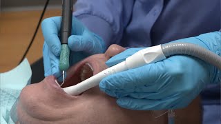 Purevac® HVE System — User Adaptation Guide — Grasp and Adaptation | Dentsply Sirona