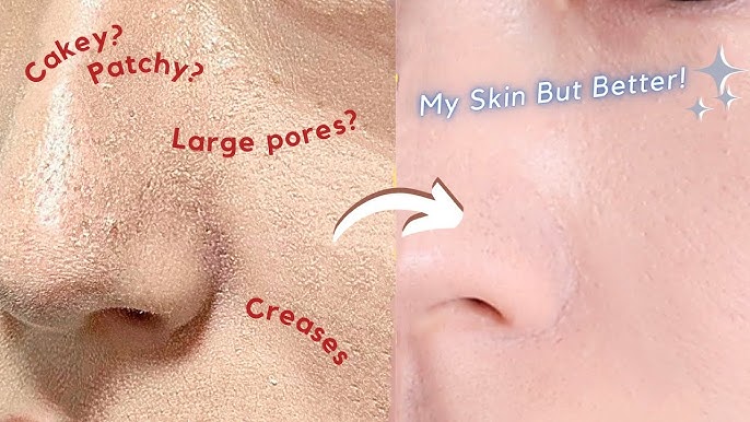 Before Makeup Oily Acne E Skin