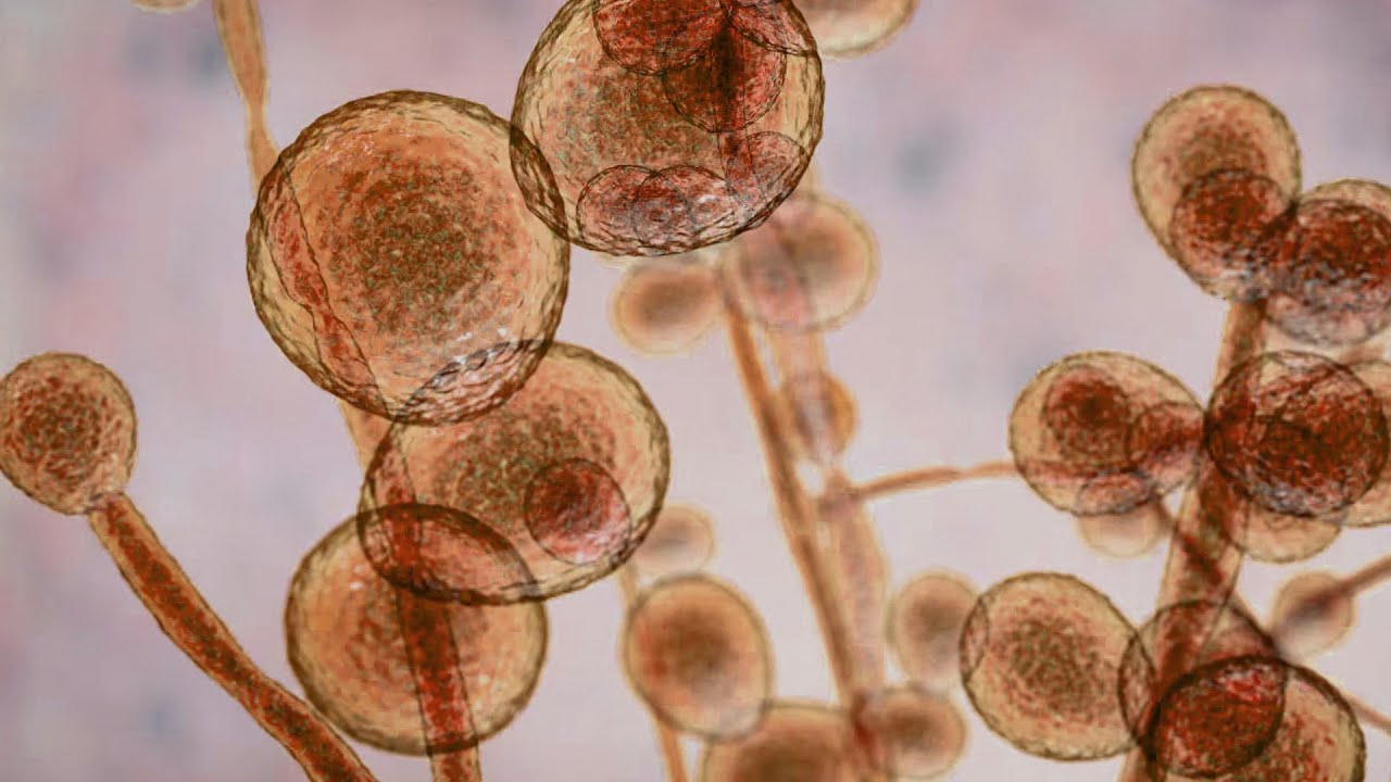 Micosi invasive, come prevenirle e trattarle - clipSALUTE