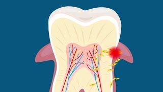 Healing Gum and Teeth  with These 5 Proven Methods