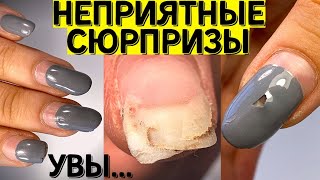 Сюрпризы под гель лаком 😲 Берегите ногти и делайте маникюр правильно!