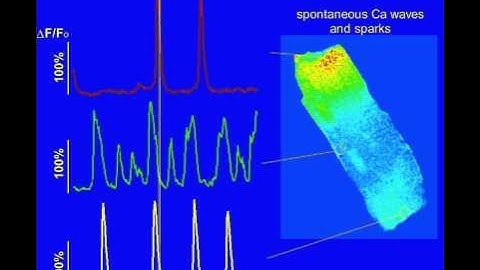 Confocal Image Sequence of Spontaneous Calcium Waves and Sparks of Fluo-4 loaded Cardiac Myocyte.avi