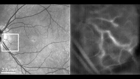 Retinal blood flow revealed by digital holography