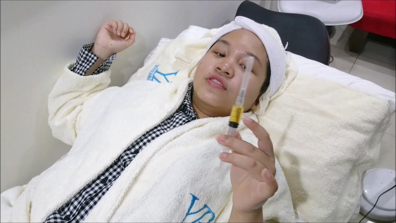 Vampire Facial Treatment (PRP) at Youth Beauty Clinic ...