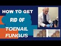 Say goodbye to fungal toenails discover the causes treatments and prevention methods