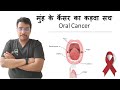 Dr rudra mohan       bitter truth about oral cancer      