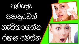 කුරුලෑ පහසුවෙන් සුවකර ගන්නා හැටි Kurula Walata Beheth Surangi Akka