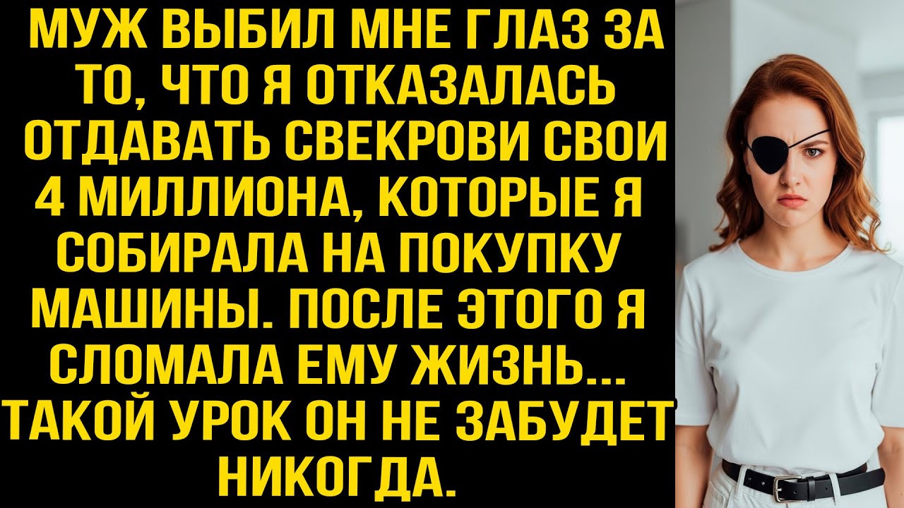 Муж выбил мне глаз за то, что я отказалась давать свекрови свои 4 млн., которые я собирала на машину