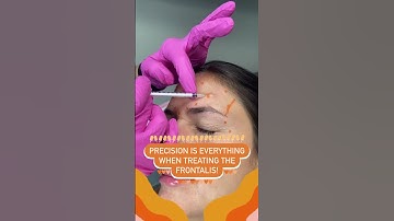Precision is Everything when Treating the Frontalis