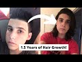 Hair Growth Time Lapse, Guy Grows Out Hair For A Year And A Half