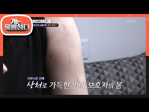 ＂셀 수 없이 많은 멍 자국😖＂ 이쁘니의 공격성에 상처투성이가 된 보호자의 몸  [개는 훌륭하다/Dogs Are Incredible] | KBS 240506 방송